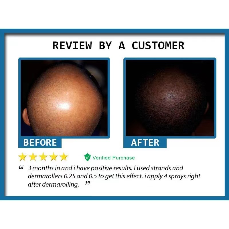 Minoxidil Strands Hair Growth Spray
