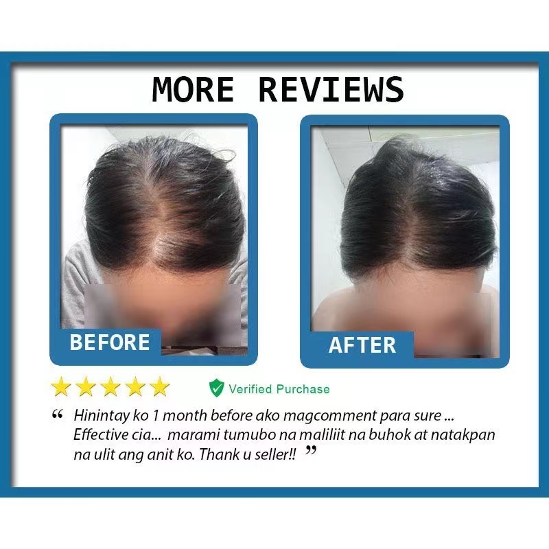 Minoxidil Strands Hair Growth Spray