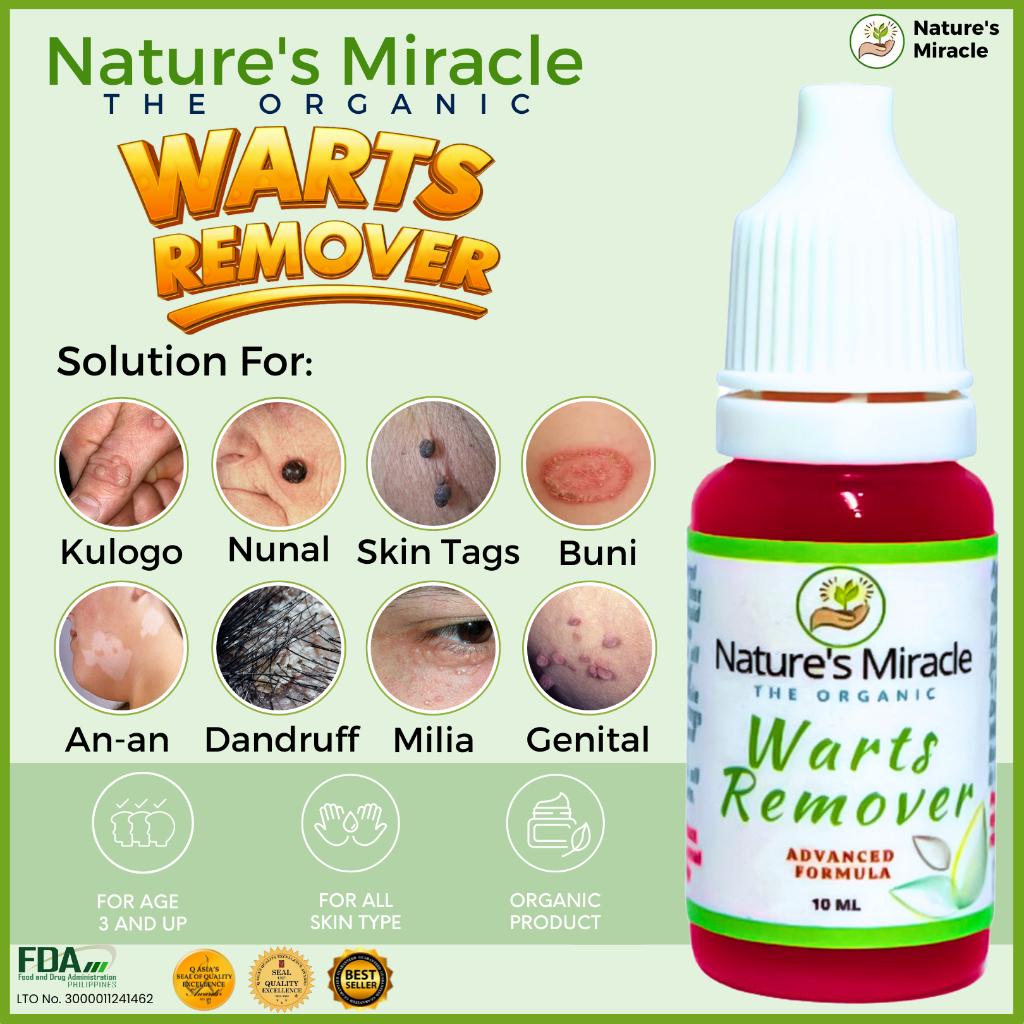 Warts Remover Kasoy Oil Warts Remover Original Mole Remover Kulogo Buni Removal By Nature