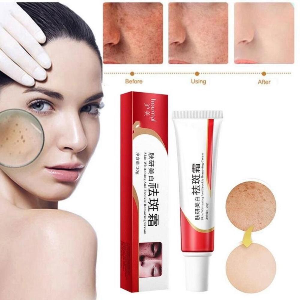 FreeShipping Philippines Melasma Cream Buy1Take1 Pekas Remover Skin Whitening Moisturizing Anti-Freckle Collagen